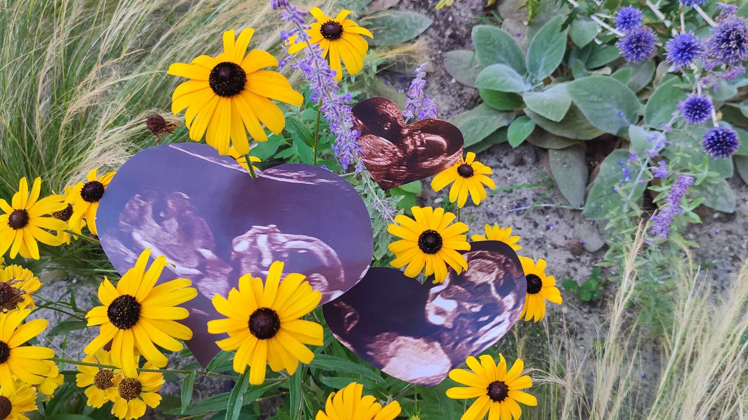 Yellow black-eyed Susan flowers with heart-shaped ultrasound photos placed among the blooms, surrounded by green foliage and purple globe thistle flowers in a garden setting.